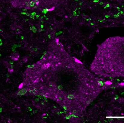 درمان اپی ژنتیک می تواند به بازسازی نخاع پس از آسیب کمک کند